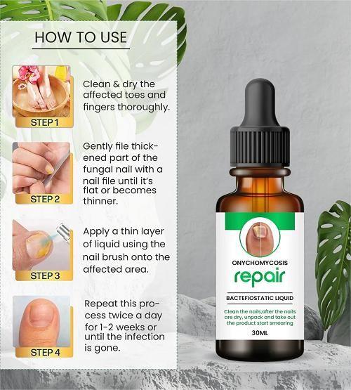 Nail serum for nail repair, fungal infection, anti-infective removal, 100% Natural(Buy 1 Get 1 Free For Today)