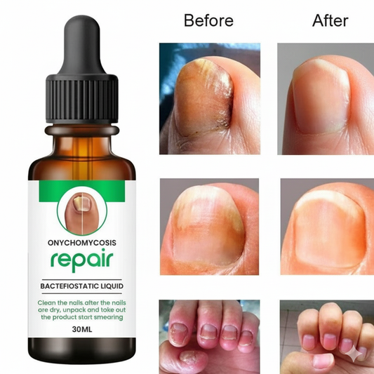 Nail serum for nail repair, fungal infection, anti-infective removal, 100% Natural(Buy 1 Get 1 Free For Today)