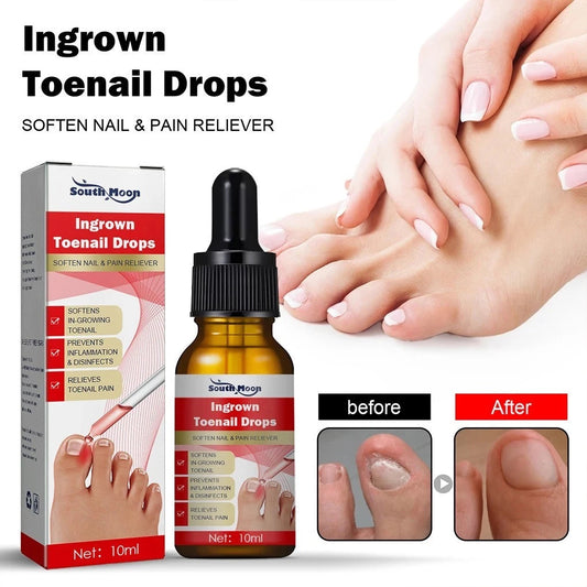 Ingrown Toenail Drops 60 ml Pack of 2